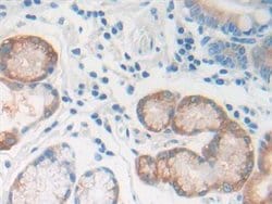 Invitrogen REG1B Polyclonal Antibody 200 &mu;L; Unconjugated:Antibodies,