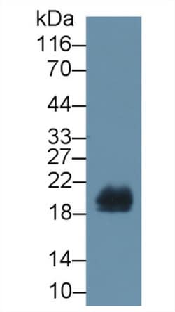 Invitrogen REG1B Polyclonal Antibody 20 &mu;L; Unconjugated:Antibodies,