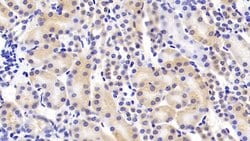 Invitrogen Renin Polyclonal Antibody 20 &mu;L; Unconjugated:Antibodies,