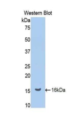 Invitrogen Renin Polyclonal Antibody 20 &mu;L; Unconjugated:Antibodies,