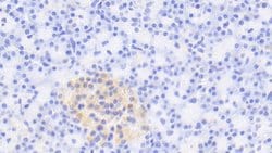Invitrogen RTN1 Polyclonal Antibody:Antibodies:Primary Antibodies