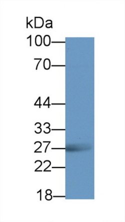 Invitrogen RTN1 Polyclonal Antibody:Antibodies:Primary Antibodies
