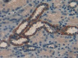 Invitrogen RBP1 Polyclonal Antibody 20 &mu;L; Unconjugated:Antibodies,