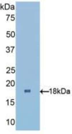 Invitrogen RBP1 Polyclonal Antibody 20 &mu;L; Unconjugated:Antibodies,