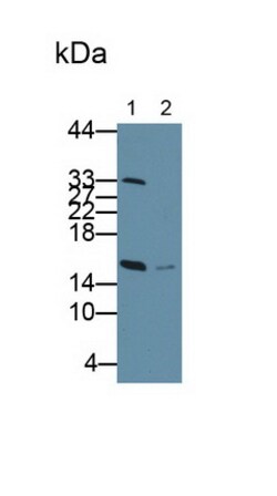 Invitrogen RBP1 Polyclonal Antibody:Antibodies:Primary Antibodies