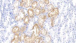 Invitrogen RBP4 Polyclonal Antibody:Antibodies:Primary Antibodies