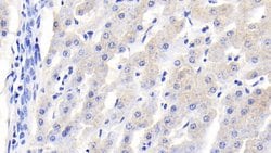 Invitrogen RBP4 Polyclonal Antibody:Antibodies:Primary Antibodies