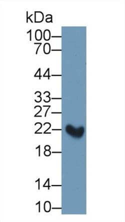 Invitrogen RBP4 Polyclonal Antibody:Antibodies:Primary Antibodies