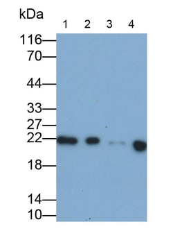 Invitrogen RBP4 Polyclonal Antibody 20 &mu;L; Unconjugated:Antibodies,