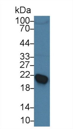 Invitrogen RBP4 Polyclonal Antibody:Antibodies:Primary Antibodies