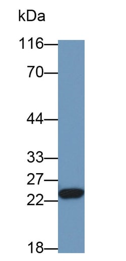 Invitrogen RBP4 Polyclonal Antibody 20 &mu;L; Unconjugated:Antibodies,