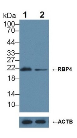 Invitrogen RBP4 Polyclonal Antibody:Antibodies:Primary Antibodies