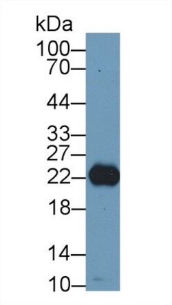 Invitrogen RBP4 Polyclonal Antibody 20 &mu;L; Unconjugated:Antibodies,