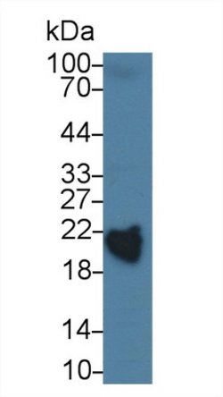 Invitrogen RBP4 Polyclonal Antibody:Antibodies:Primary Antibodies