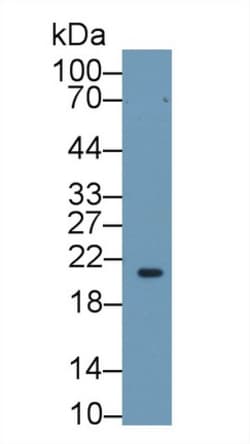 Invitrogen RBP4 Polyclonal Antibody 20 &mu;L; Unconjugated:Antibodies,
