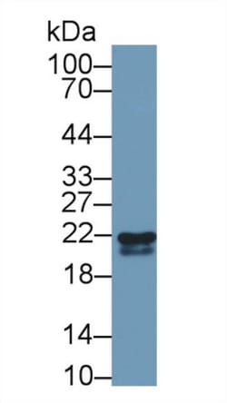Invitrogen RBP4 Polyclonal Antibody 20 &mu;L; Unconjugated:Antibodies,