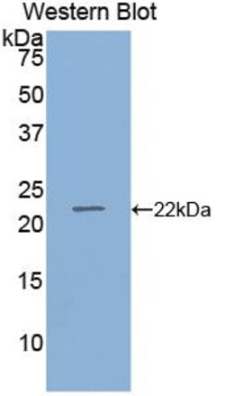 Invitrogen RBP4 Polyclonal Antibody 20 &mu;L; Unconjugated:Antibodies,
