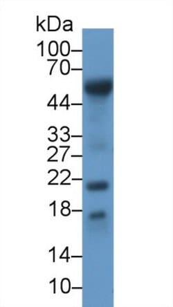 Invitrogen RBP7 Polyclonal Antibody 200 &mu;L; Unconjugated:Antibodies,