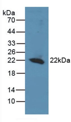 Invitrogen REV1 Polyclonal Antibody:Antibodies:Primary Antibodies