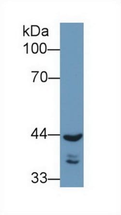 Invitrogen REV1 Polyclonal Antibody:Antibodies:Primary Antibodies