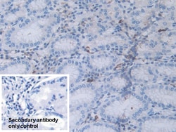 Invitrogen RNaseL Polyclonal Antibody 20 &mu;L; Unconjugated:Antibodies,