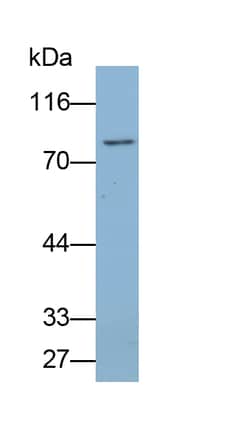 Invitrogen RNaseL Polyclonal Antibody 20 &mu;L; Unconjugated:Antibodies,