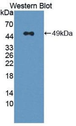 Invitrogen RNF39 Polyclonal Antibody:Antibodies:Primary Antibodies