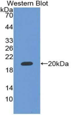 Invitrogen Rbm20 Polyclonal Antibody 20 μL; Unconjugated:Antibodies,