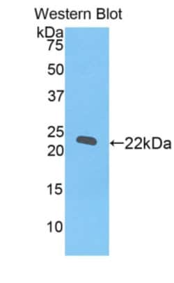 Invitrogen REXO2 Polyclonal Antibody 200 &mu;L; Unconjugated:Antibodies,