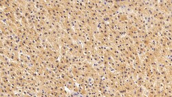 Invitrogen S100A6 Polyclonal Antibody 20 &mu;L; Unconjugated:Antibodies,
