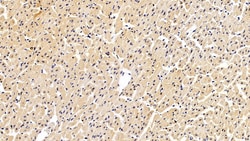 Invitrogen S100A6 Polyclonal Antibody 20 &mu;L; Unconjugated:Antibodies,