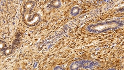 Invitrogen S100A6 Polyclonal Antibody 20 &mu;L; Unconjugated:Antibodies,