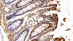 Invitrogen S100A6 Polyclonal Antibody 20 &mu;L; Unconjugated:Antibodies,