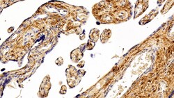 Invitrogen S100A6 Polyclonal Antibody 20 &mu;L; Unconjugated:Antibodies,