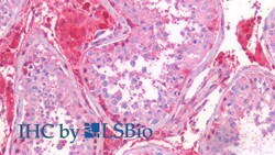 Invitrogen S100A6 Polyclonal Antibody 20 &mu;L; Unconjugated:Antibodies,