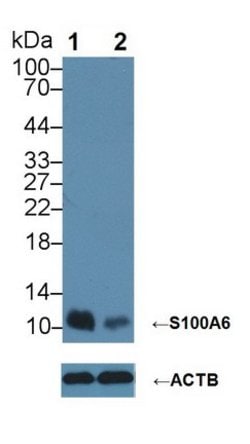 Invitrogen S100A6 Polyclonal Antibody 20 &mu;L; Unconjugated:Antibodies,