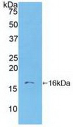 Invitrogen S100A6 Polyclonal Antibody 20 &mu;L; Unconjugated:Antibodies,