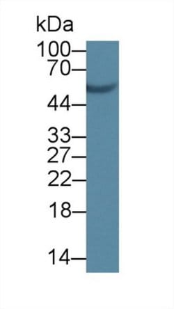 Invitrogen SCRN1 Polyclonal Antibody:Antibodies:Primary Antibodies