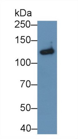 Invitrogen SEMA5B Polyclonal Antibody:Antibodies:Primary Antibodies