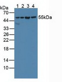 Invitrogen SHMT2 Polyclonal Antibody:Antibodies:Primary Antibodies