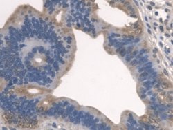 Invitrogen SPTLC1 Polyclonal Antibody 20 &mu;L; Unconjugated:Antibodies,