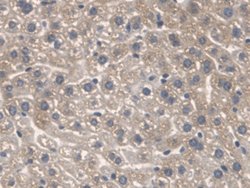 Invitrogen SPTLC1 Polyclonal Antibody 20 &mu;L; Unconjugated:Antibodies,