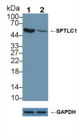 Invitrogen SPTLC1 Polyclonal Antibody 20 &mu;L; Unconjugated:Antibodies,