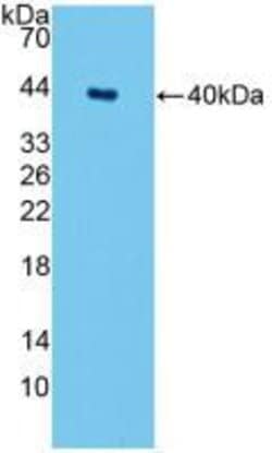 Invitrogen SPTLC1 Polyclonal Antibody 20 &mu;L; Unconjugated:Antibodies,