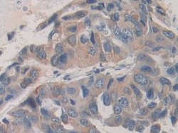 Invitrogen SHC3 Polyclonal Antibody:Antibodies:Primary Antibodies