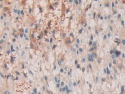 Invitrogen SHC3 Polyclonal Antibody:Antibodies:Primary Antibodies