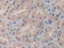 Invitrogen SHC3 Polyclonal Antibody:Antibodies:Primary Antibodies