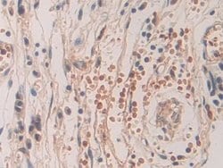 Invitrogen SHC3 Polyclonal Antibody:Antibodies:Primary Antibodies