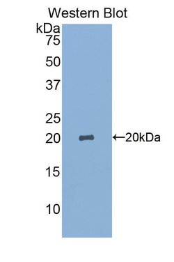 Invitrogen SIGLEC14 Polyclonal Antibody:Antibodies:Primary Antibodies