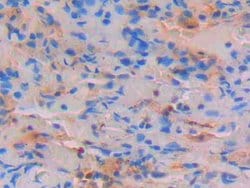 Invitrogen STAT4 Polyclonal Antibody:Antibodies:Primary Antibodies